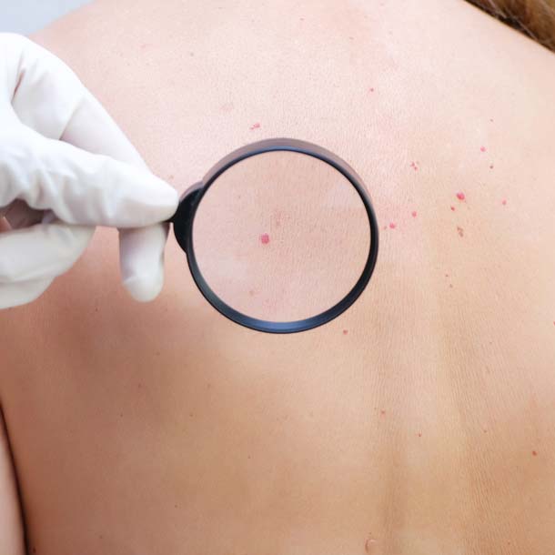 Dermatologia | Mastroluca Medical House Roma