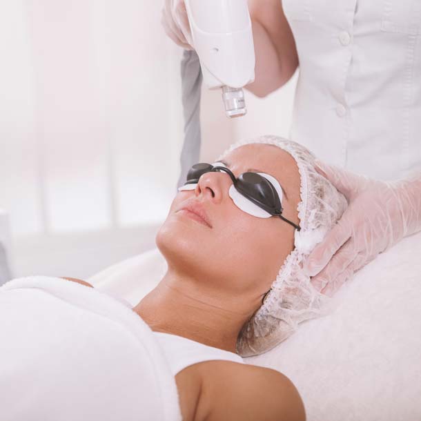 Laser Macchie | Mastroluca Medical House Roma