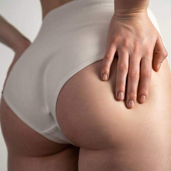 trattamento anticellulite laser roma