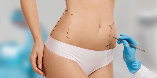 Chirurgia del corpo roma